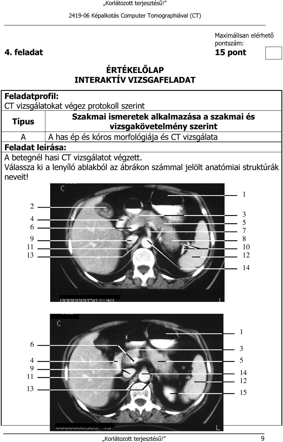 alkalmazása a szakmai és Típus vizsgakövetelmény szerint A A has ép és kóros morfológiája és CT vizsgálata Feladat leírása: A betegnél