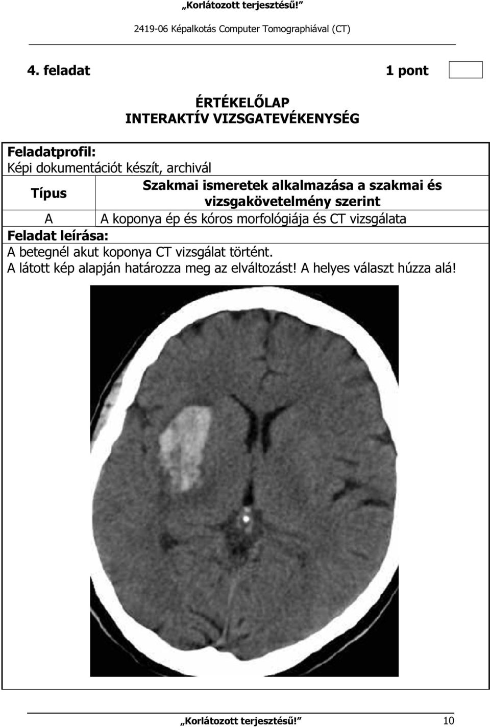 ismeretek alkalmazása a szakmai és Típus vizsgakövetelmény szerint A A koponya ép és kóros morfológiája és CT