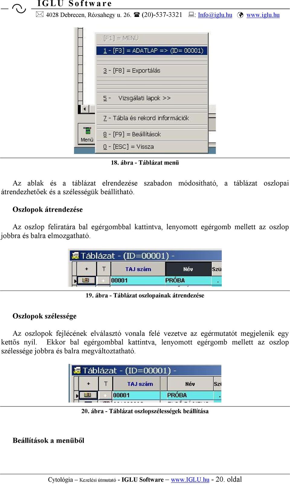 ábra - Táblázat oszlopainak átrendezése Oszlopok szélessége Az oszlopok fejlécének elválasztó vonala felé vezetve az egérmutatót megjelenik egy kettős nyíl.