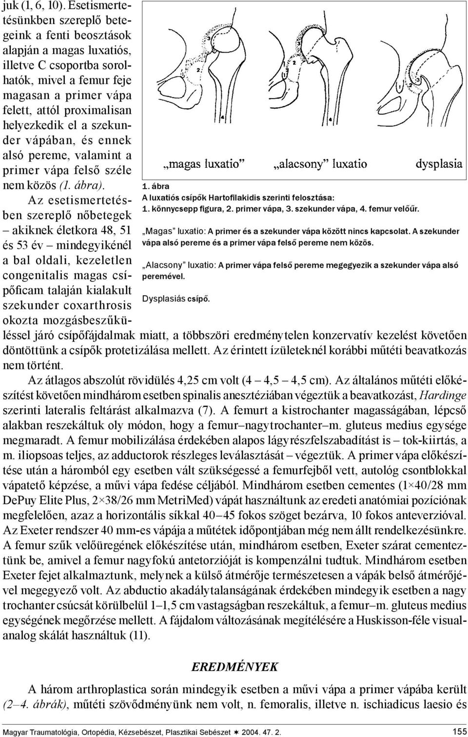 Alacsony luxatio: A primer vápa felső pereme megegyezik a szekunder vápa alsó peremével. Dysplasiás csípő. juk (1, 6, 10).