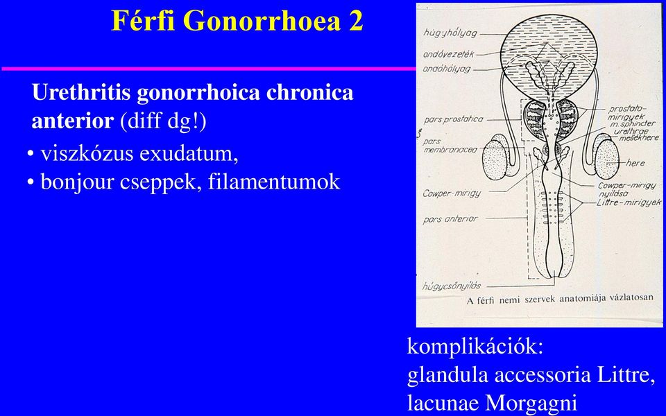 ) viszkózus exudatum, bonjour cseppek,