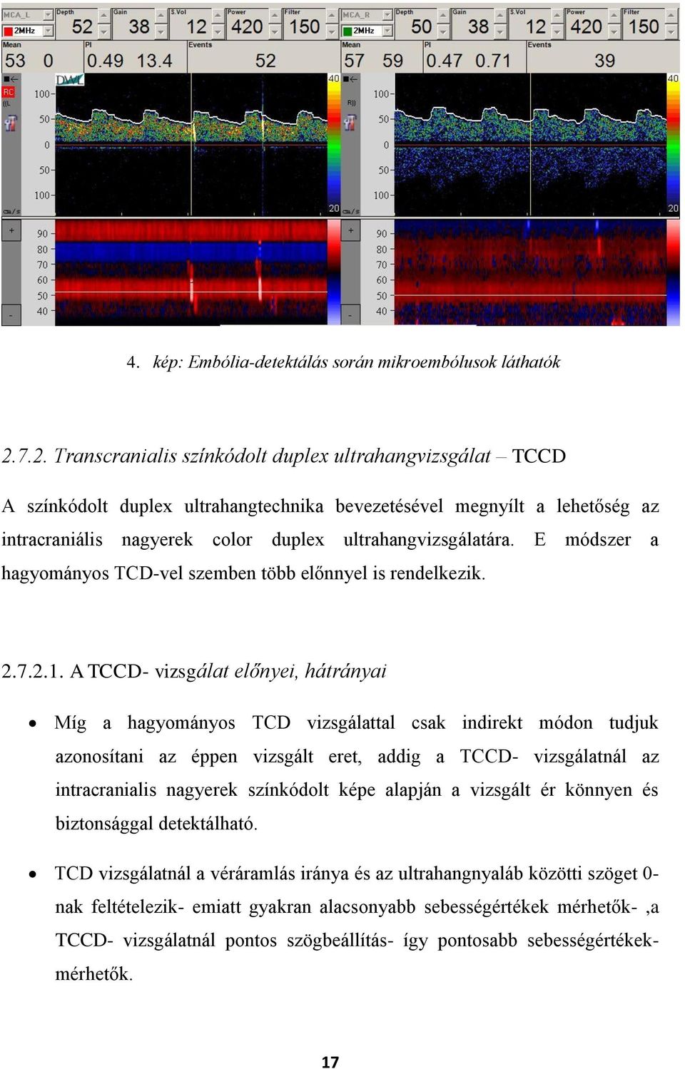 E módszer a hagyományos TCD-vel szemben több előnnyel is rendelkezik. 2.7.2.1.