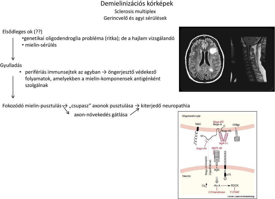 perifériás immunsejtek az agyban öngerjesztő védekező folyamatok, amelyekben a mielin-komponensek