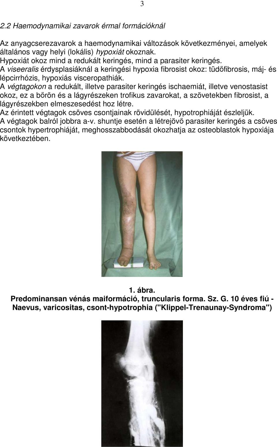 A végtagokon a redukált, illetve parasiter keringés ischaemiát, illetve venostasist okoz, ez a bırön és a lágyrészeken trofikus zavarokat, a szövetekben fibrosist, a lágyrészekben elmeszesedést hoz