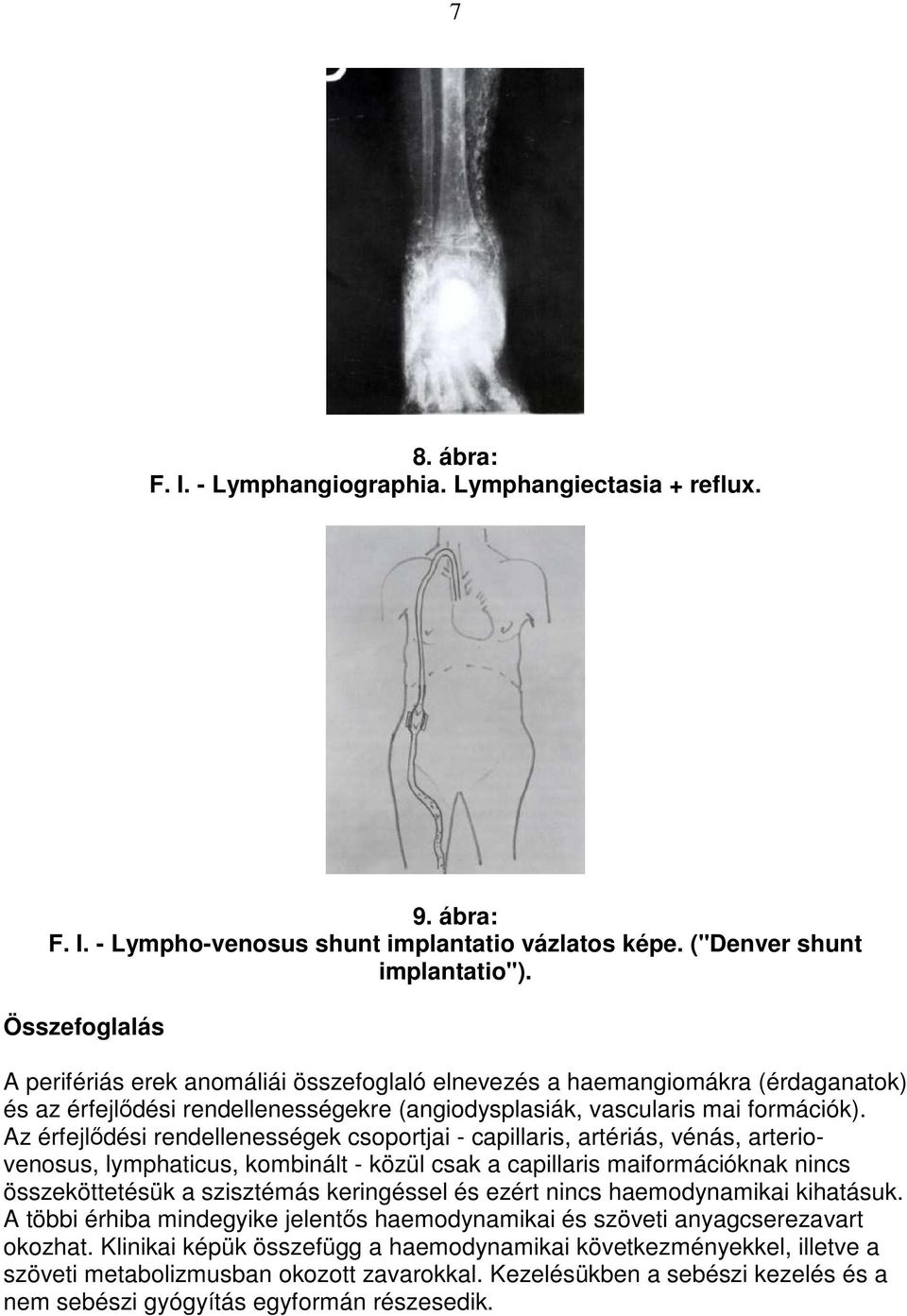 Az érfejlıdési rendellenességek csoportjai - capillaris, artériás, vénás, arteriovenosus, lymphaticus, kombinált - közül csak a capillaris maiformációknak nincs összeköttetésük a szisztémás