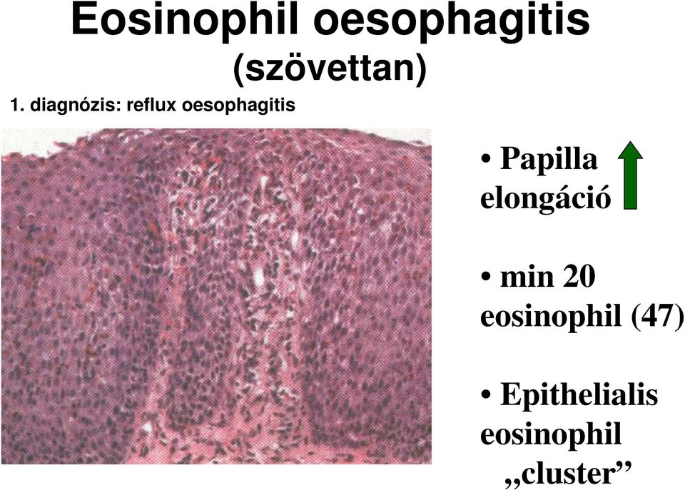 (szövettan) Papilla elongáció min