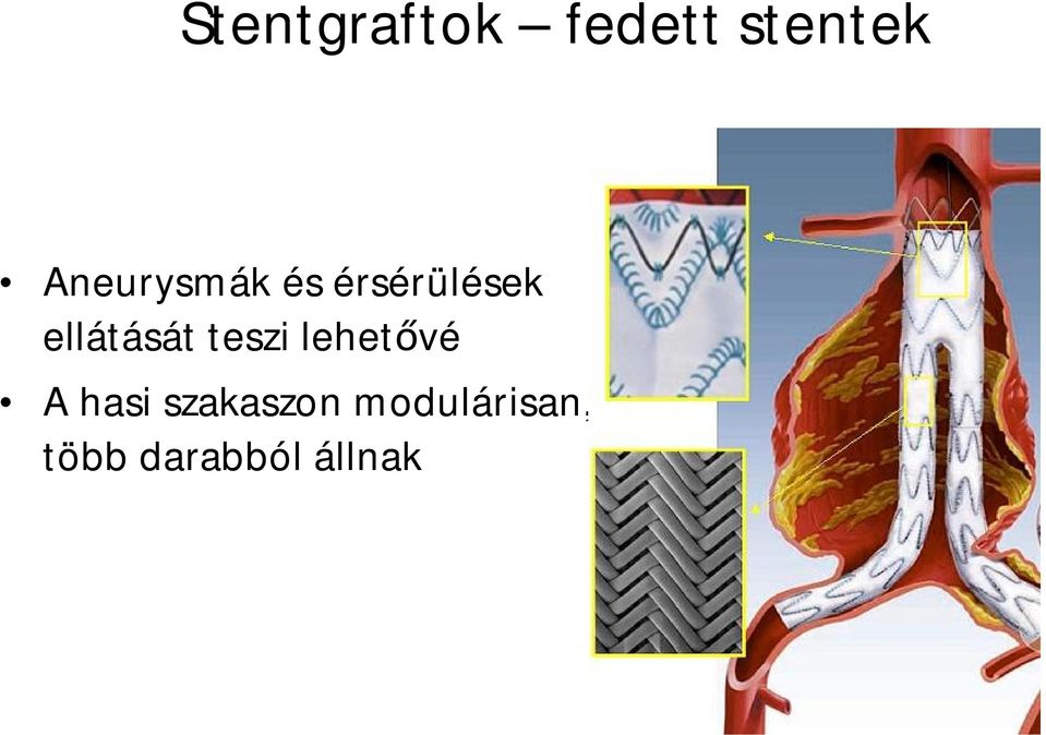 ellátását teszi lehetővé A hasi