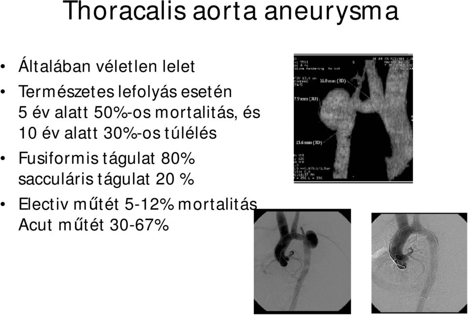 és 10 év alatt 30%-os túlélés Fusiformis tágulat 80%