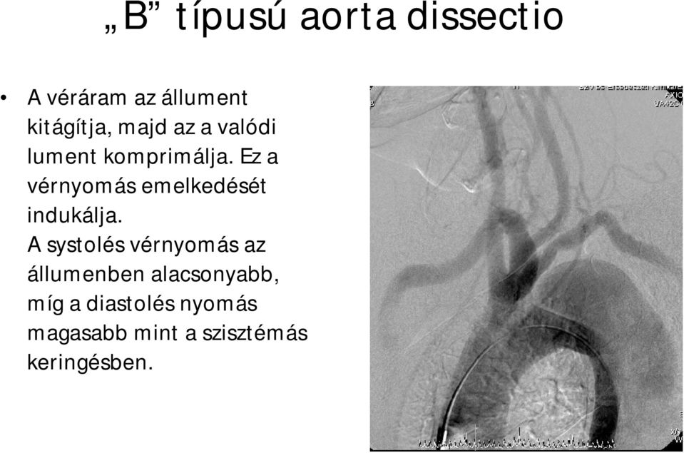 Ez a vérnyomás emelkedését indukálja.