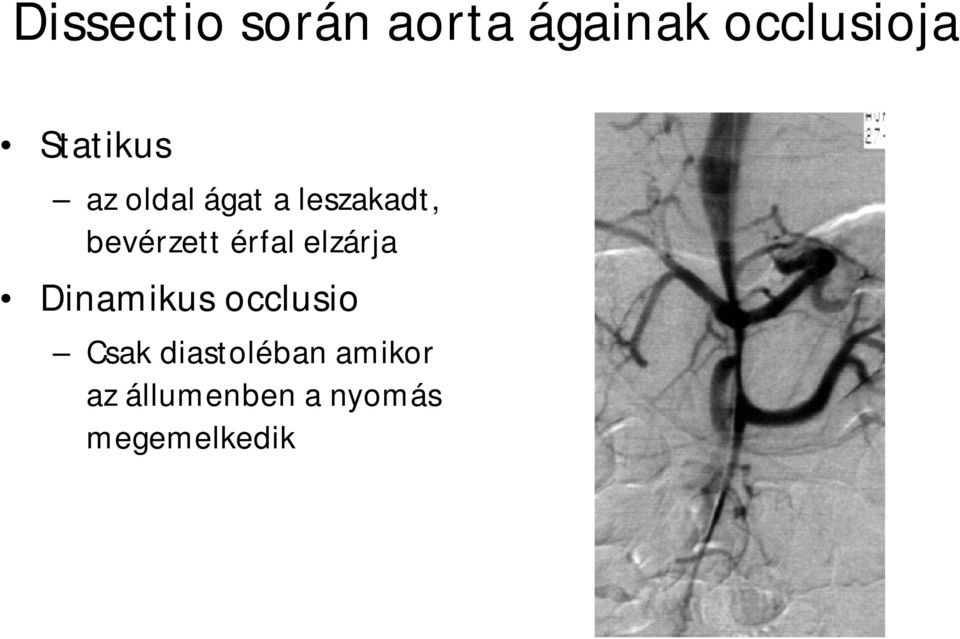 bevérzett érfal elzárja Dinamikus occlusio