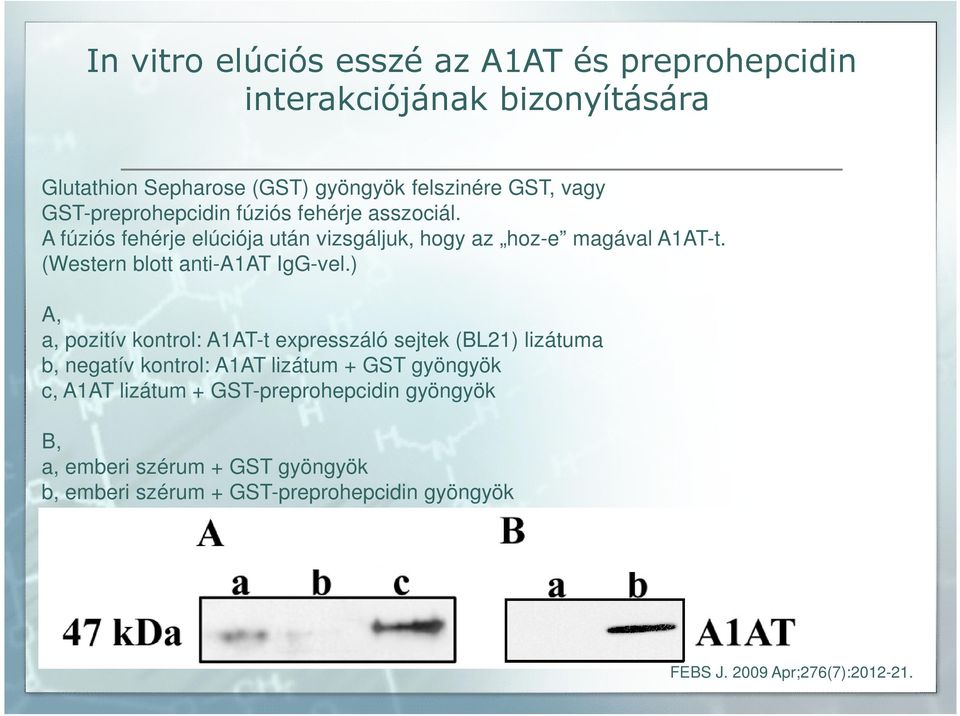 (Western blott anti-a1at IgG-vel.