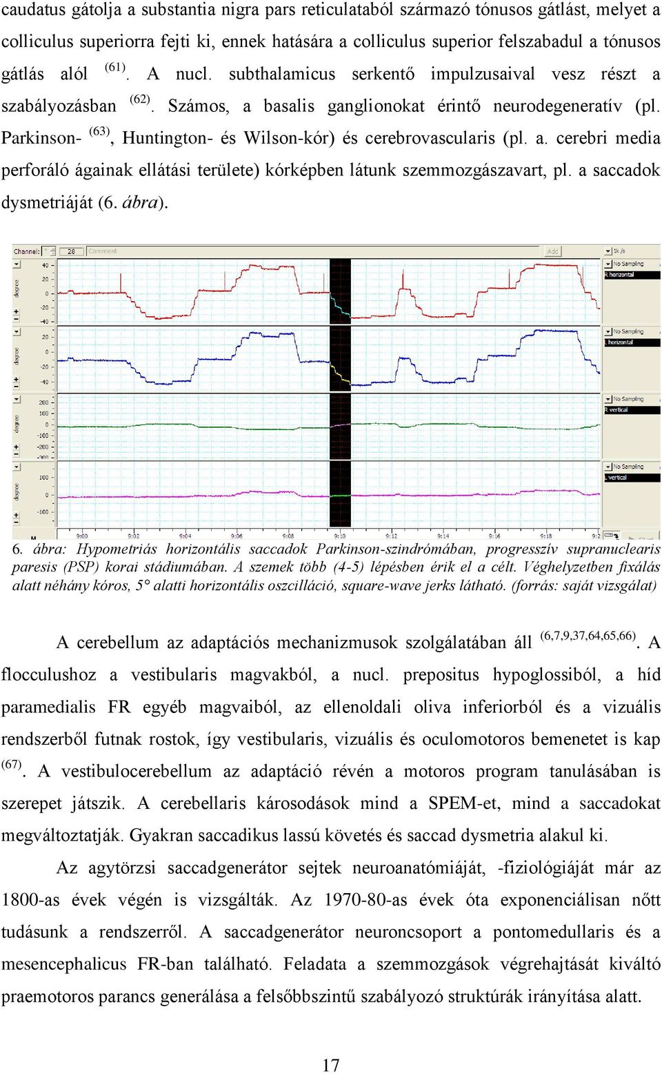 Parkinson- (63), Huntington- és Wilson-kór) és cerebrovascularis (pl. a. cerebri media perforáló ágainak ellátási területe) kórképben látunk szemmozgászavart, pl. a saccadok dysmetriáját (6. ábra). 6.