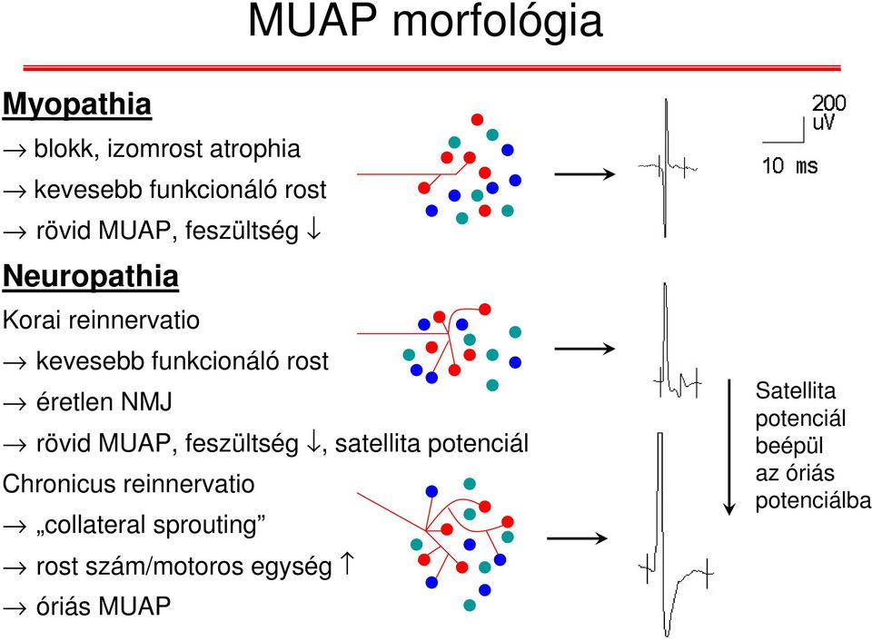 NMJ rövid MUAP, feszültség, satellita potenciál Chronicus reinnervatio collateral