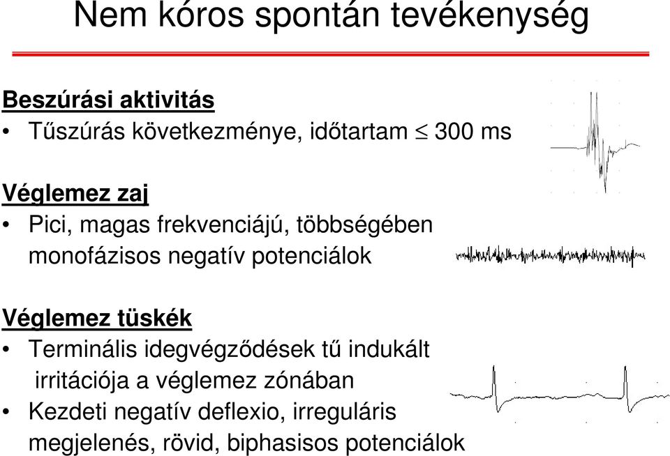 potenciálok Véglemez tüskék Terminális idegvégződések tű indukált irritációja a