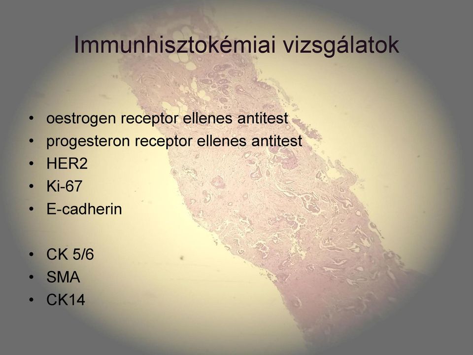 progesteron receptor ellenes