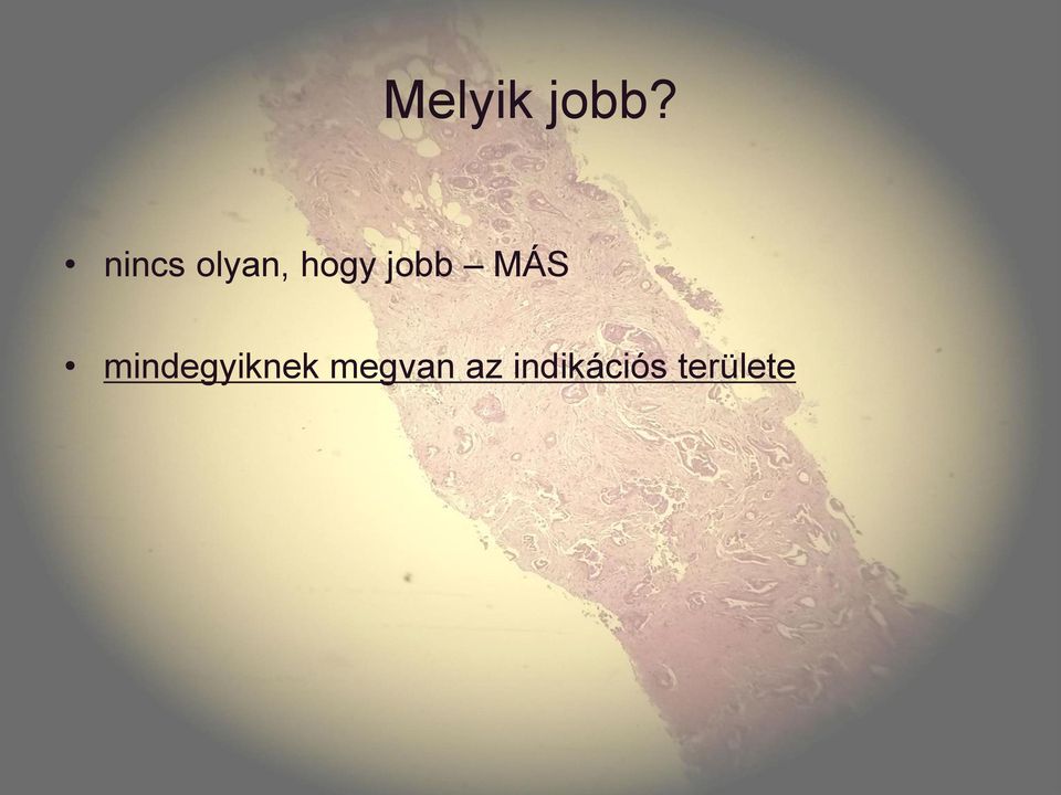 jobb MÁS