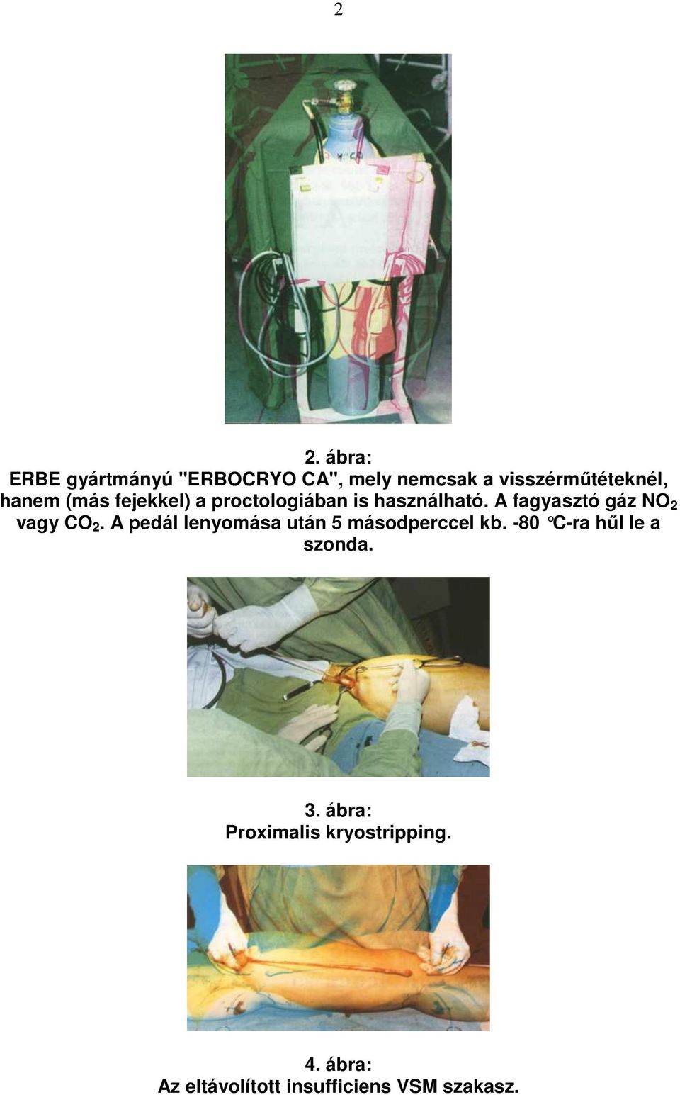 A fagyasztó gáz NO 2 vagy CO 2. A pedál lenyomása után 5 másodperccel kb.