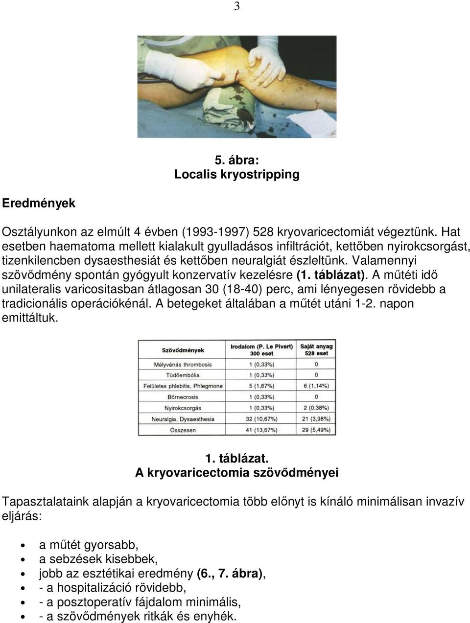 Valamennyi szövıdmény spontán gyógyult konzervatív kezelésre (1. táblázat). A mőtéti idı unilateralis varicositasban átlagosan 30 (18-40) perc, ami lényegesen rövidebb a tradicionális operációkénál.