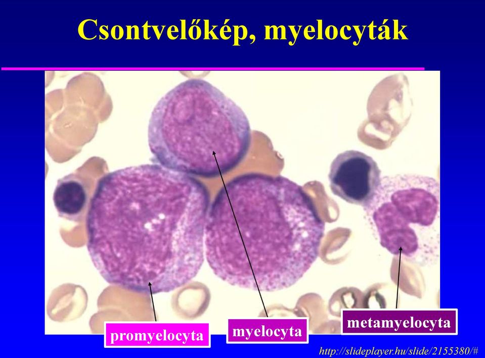metamyelocyta