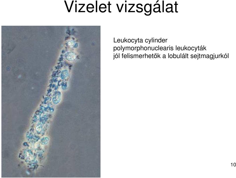 leukocyták jól felismerhetık a