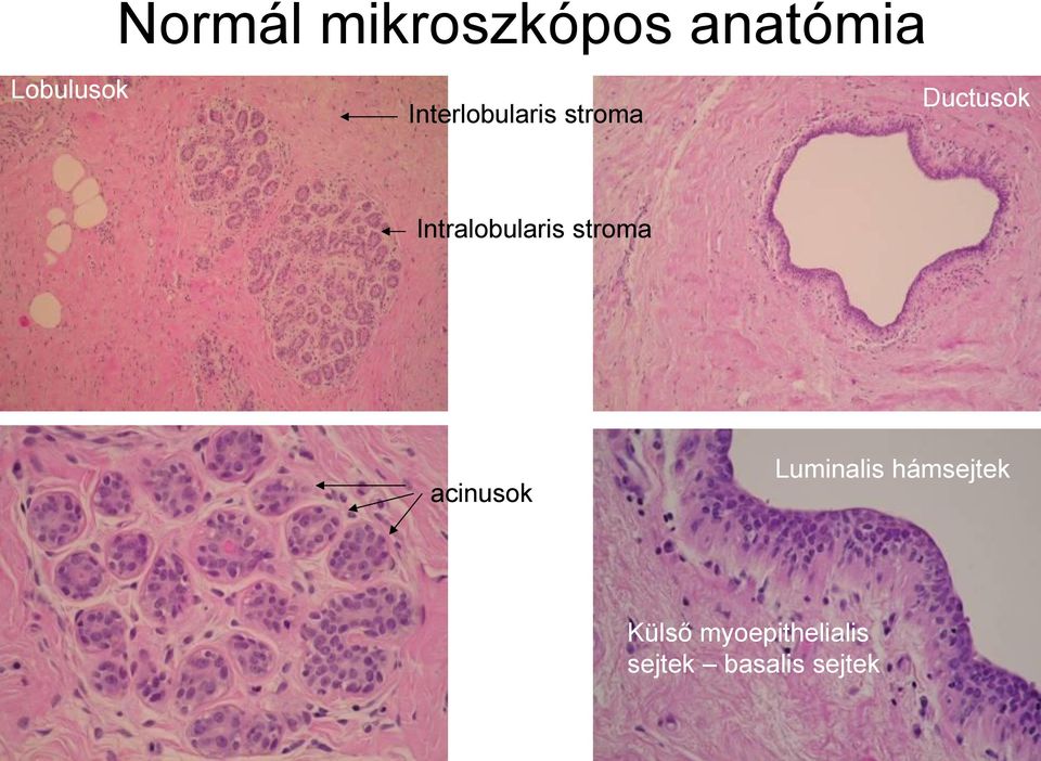 Intralobularis stroma acinusok Luminalis