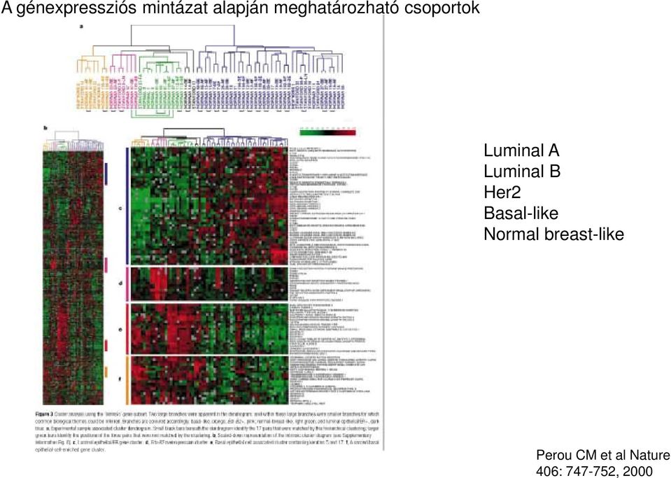 Luminal B Her2 Basal-like Normal