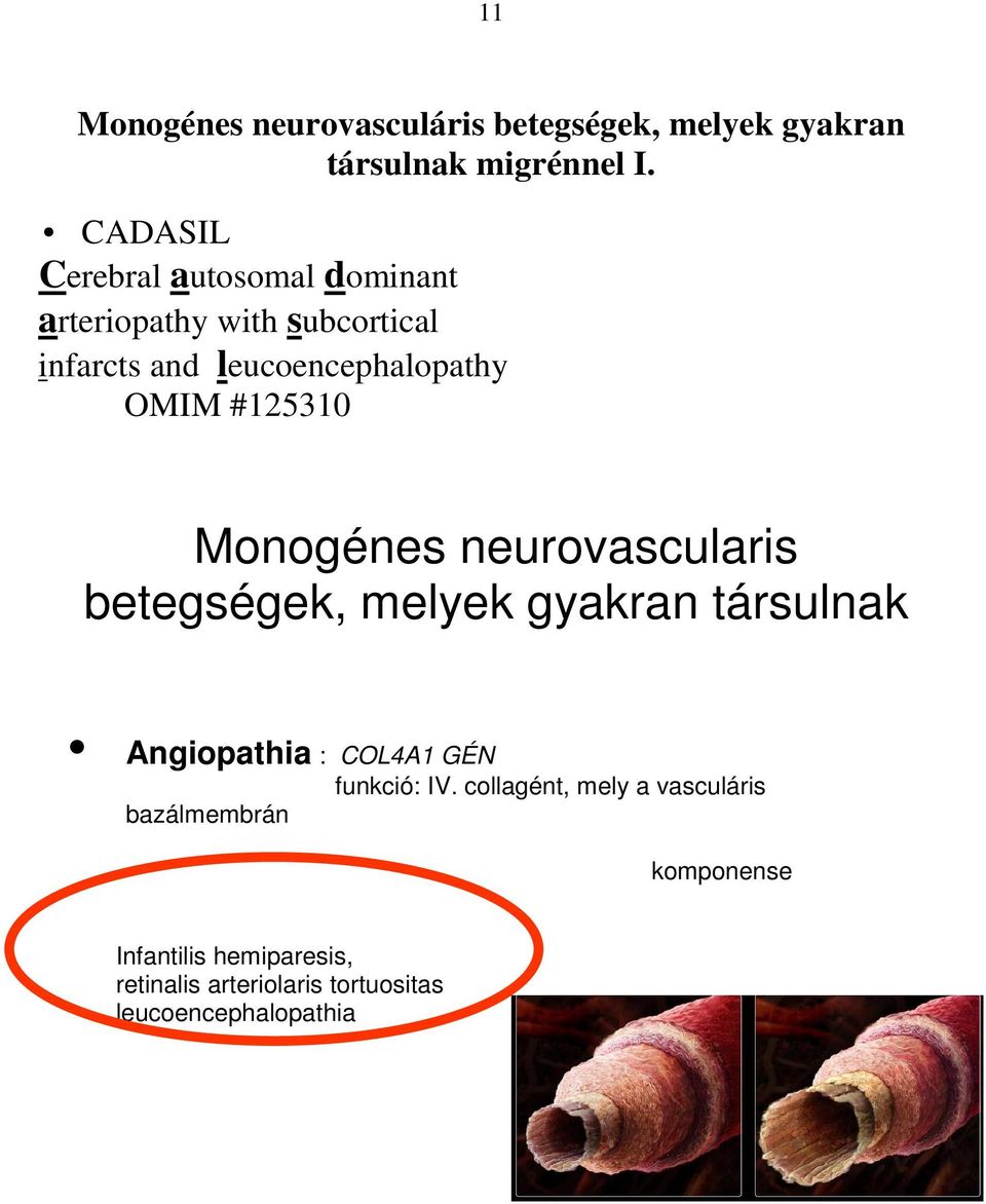 Monogénes neurovascularis betegségek, melyek gyakran társulnak Angiopathia : COL4A1 GÉN funkció: IV.