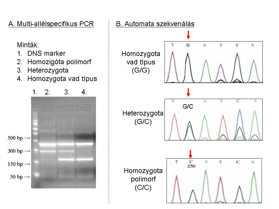 Beállítottunk egy új vizsgálati módszert a glukokortikoid receptor gén második intronjában található, az eredetileg a kimutatáshoz használt restrikciós enzim alapján BclI polimorfizmusnak keresztelt