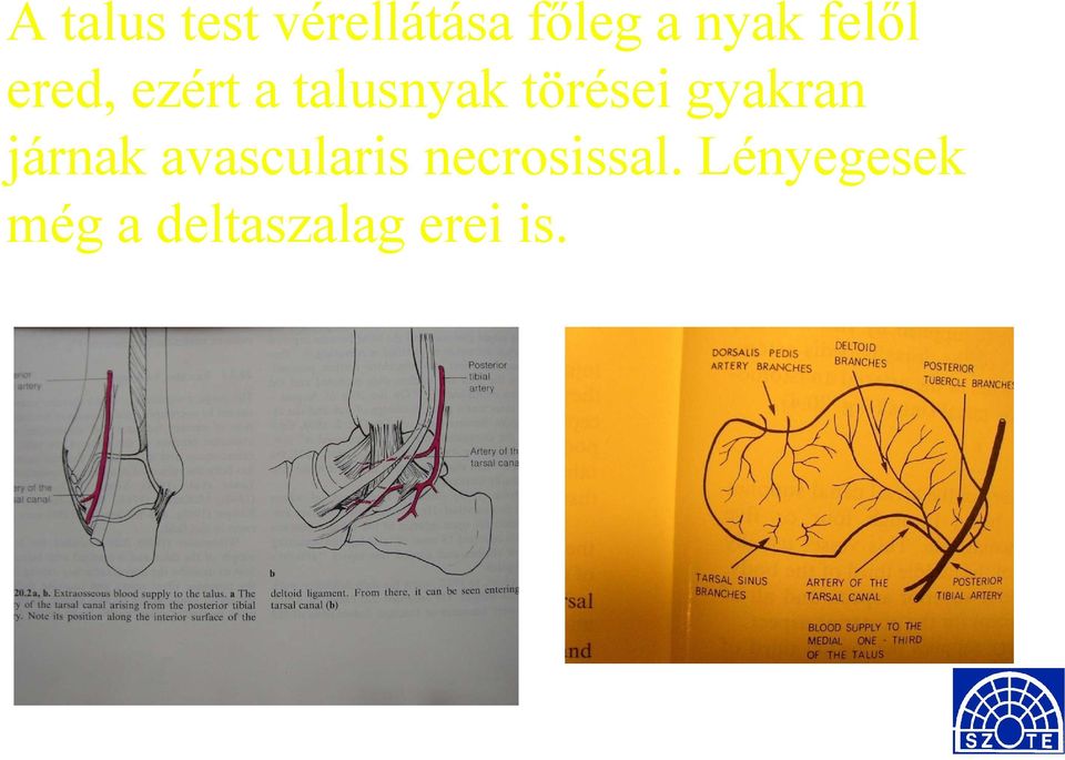 gyakran járnak avascularis necrosissal.