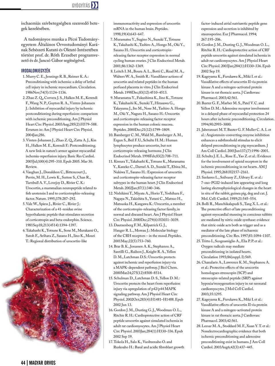 : Preconditioning with ischemia: a delay of lethal cell injury in ischemic myocardium. Circulation. 19Nov;7(5):1 113.. Zhao Z. Q., Corvera J. S., Halkos M. E., Kerendi F., Wang N. P., Guyton R. A.