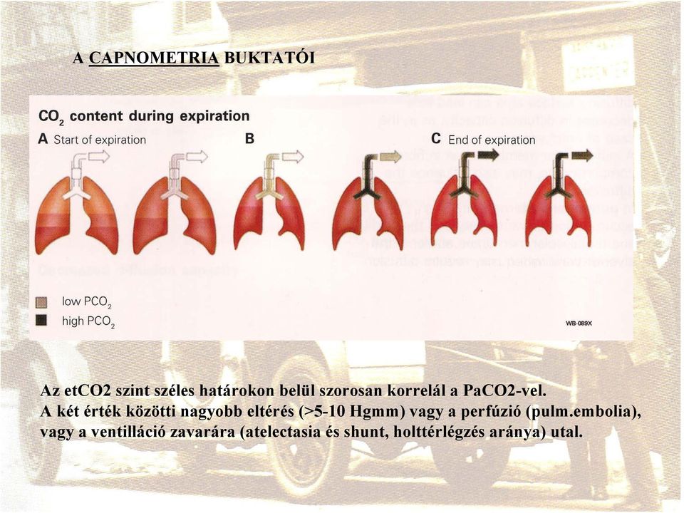 A két érték közötti nagyobb eltérés (>5-10 Hgmm) vagy a