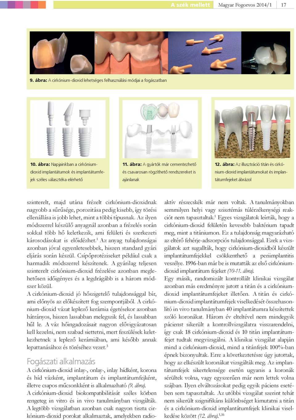 ábra: Az illusztráció titán és cirkónium-dioxid implantátumokat és implantátumfejeket ábrázol szinterelt, majd utána frézelt cirkónium-dioxidnak nagyobb a sűrűsége, porozitása pedig kisebb, így