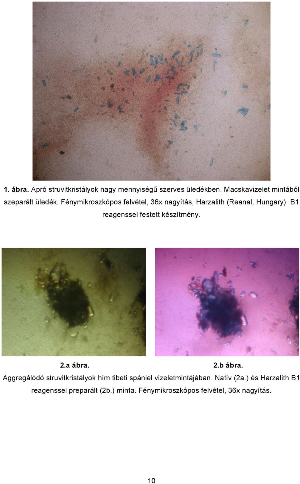 Fénymikroszkópos felvétel, 36x nagyítás, Harzalith (Reanal, Hungary) B1 reagenssel festett