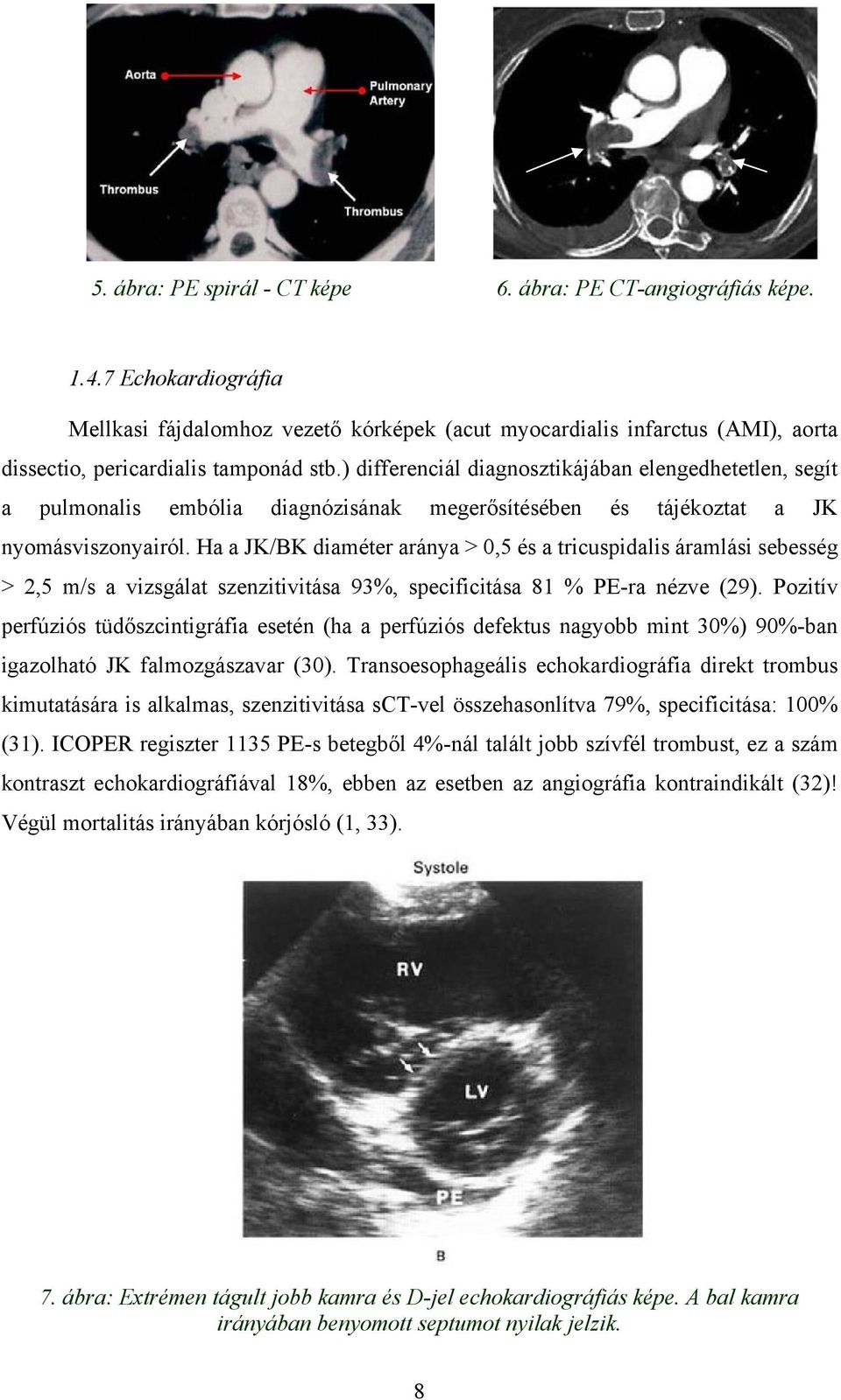 ) differenciál diagnosztikájában elengedhetetlen, segít a pulmonalis embólia diagnózisának megerősítésében és tájékoztat a JK nyomásviszonyairól.