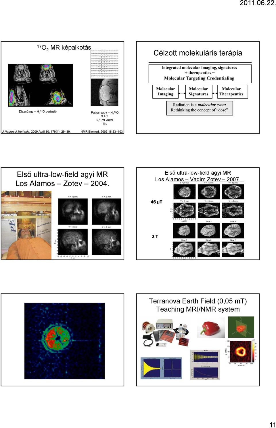 2005;18:83 103 Első ultra-low-field agyi MR Los Alamos Zotev 2004.