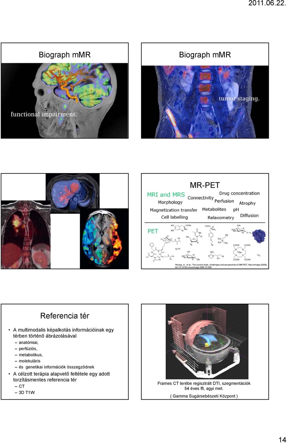 1016/j.neuroimage.2009.10.036 Referencia tér A multimodalis képalkotás információinak egy térben történő ábrázolásával anatómiai,