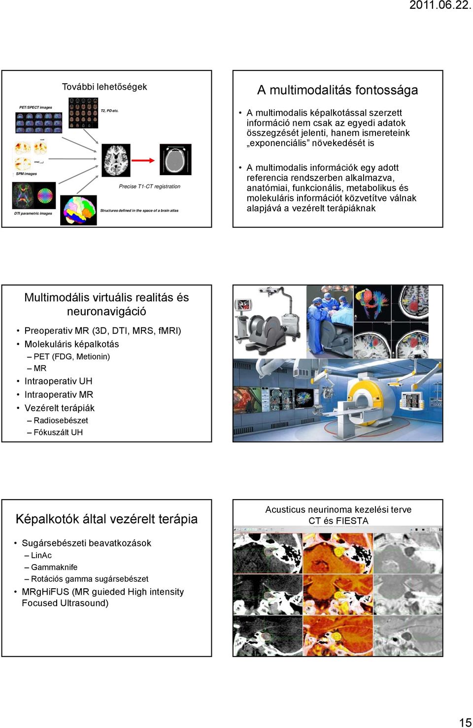 images Precise T1-CT registration Structures defined in the space of a brain atlas A multimodalis információk egy adott referencia rendszerben alkalmazva, anatómiai, funkcionális, metabolikus és