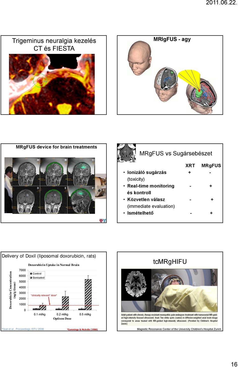 rats) Concentration tissue) Doxorubicin (ng/g 7000 6000 5000 4000 3000 2000 1000 0 Doxorubicin Uptake in Normal Brain Control Sonicated clinically relevant dose¹ 0.