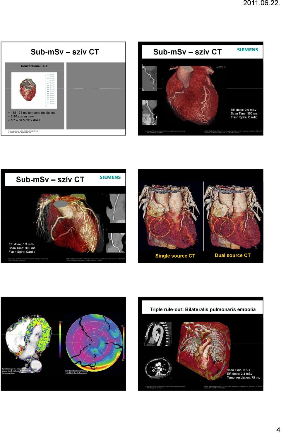 9 msv Scan Time: 350 ms Flash Spiral Cardio 1: Hausleiter et al, JAMA 2009 Feb 4;301(5):500-7 2: Alkadhi et al, Eur Radiol Sept 2009 Courtesy of Friedrich-Alexander University Erlangen-Nuremberg IMP