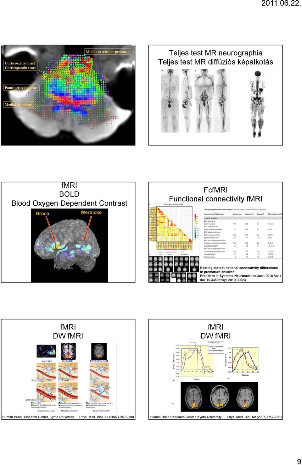 differences in premature children Frontiers in Systems Neuroscience June 2010 