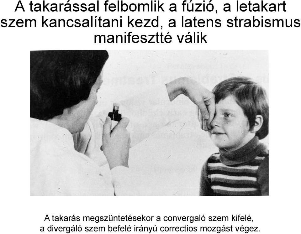 válik A takarás megszüntetésekor a convergaló szem