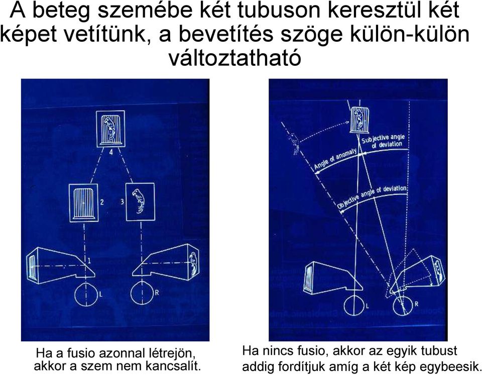 azonnal létrejön, akkor a szem nem kancsalít.