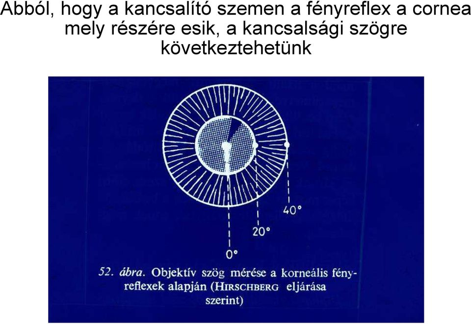 cornea mely részére esik, a