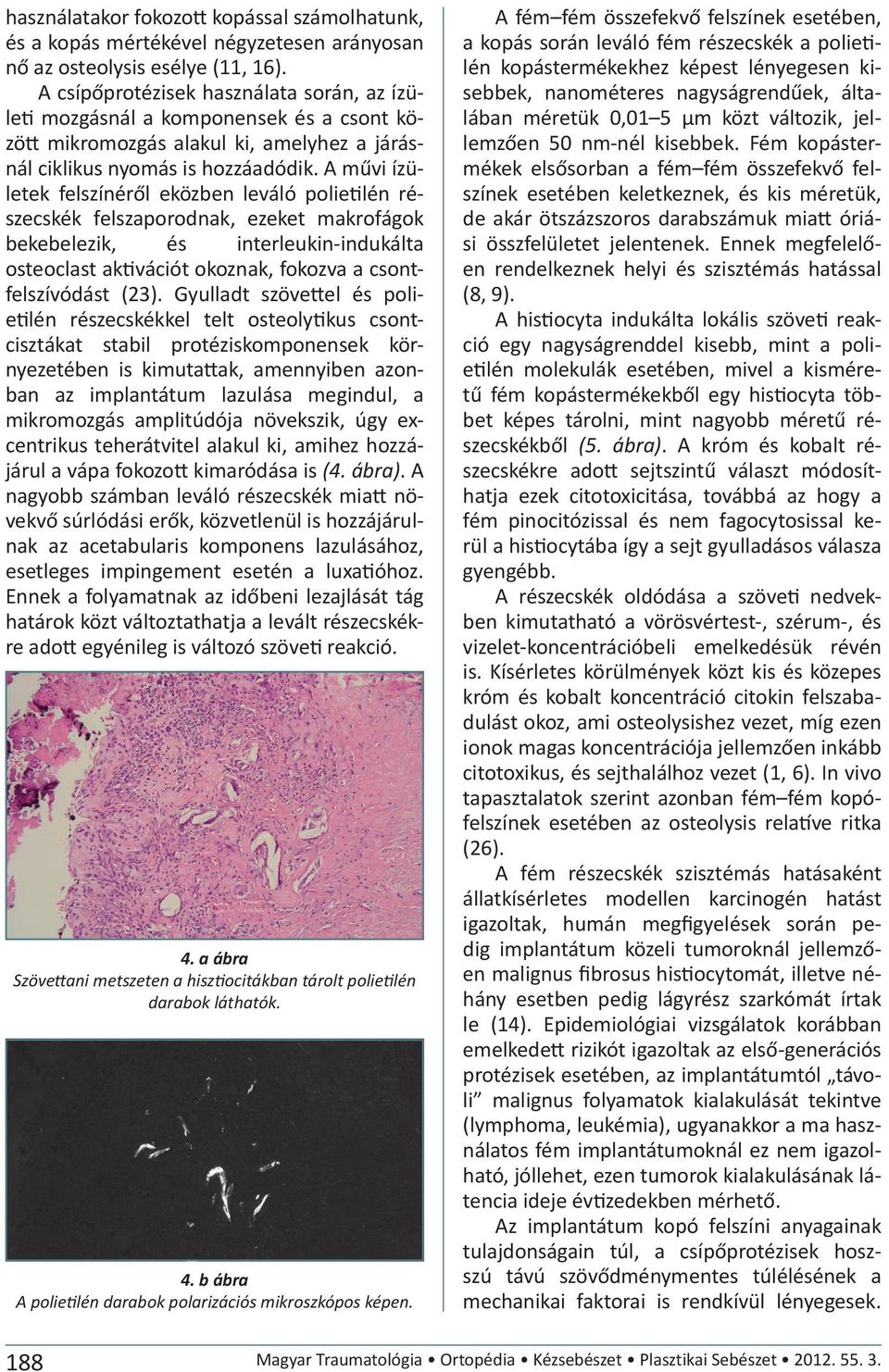 A művi ízületek felszínéről eközben leváló polietilén részecskék felszaporodnak, ezeket makrofágok bekebelezik, és interleukin-indukálta osteoclast aktivációt okoznak, fokozva a csontfelszívódást