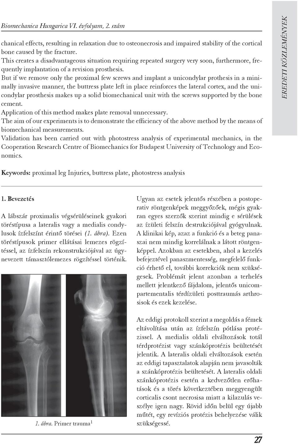 But if we remove only the proximal few screws and implant a unicondylar prothesis in a minimally invasive manner, the buttress plate left in place reinforces the lateral cortex, and the unicondylar