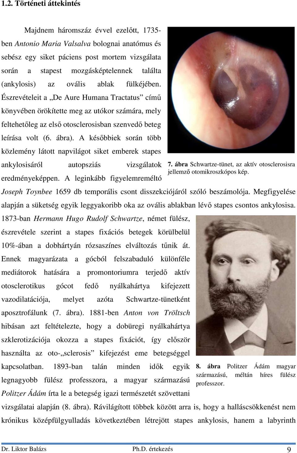 Észrevételeit a De Aure Humana Tractatus című könyvében örökítette meg az utókor számára, mely feltehetőleg az első otosclerosisban szenvedő beteg leírása volt (6. ábra).