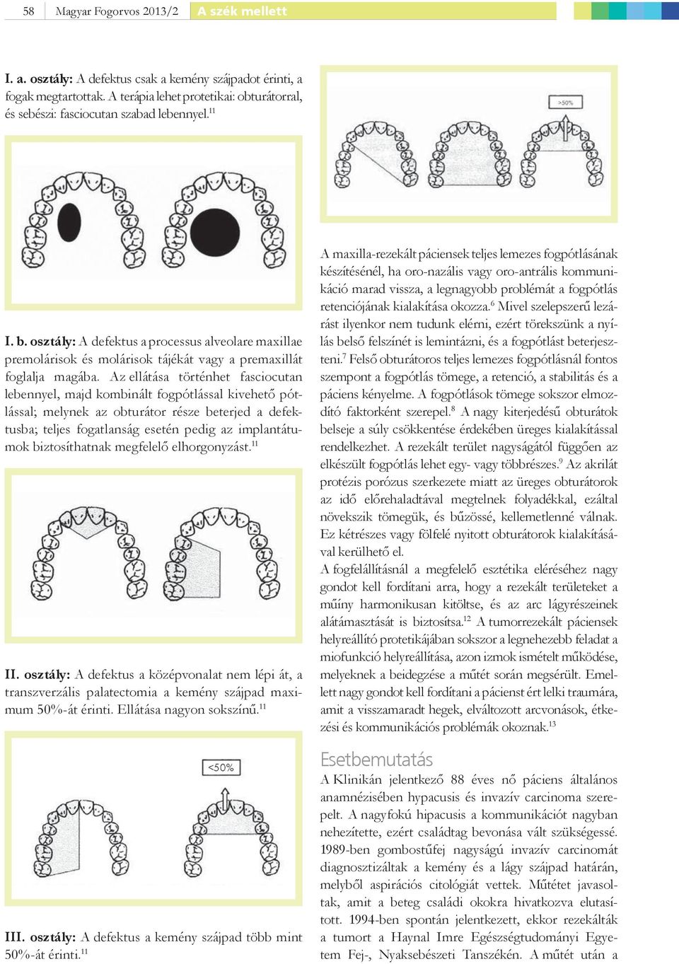 osztály: A defektus a processus alveolare maxillae premolárisok és molárisok tájékát vagy a premaxillát foglalja magába.