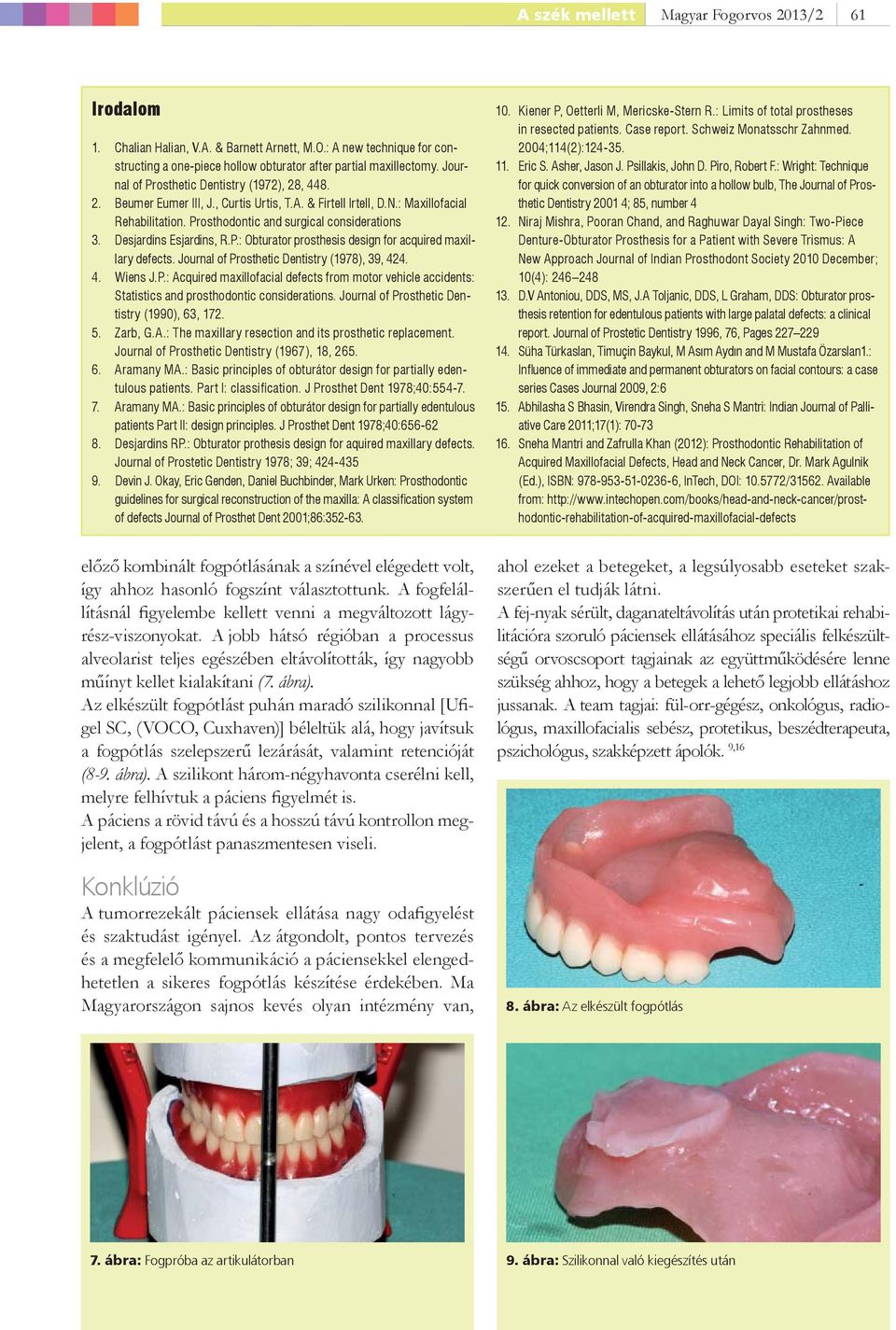 Desjardins Esjardins, R.P.: Obturator prosthesis design for acquired maxillary defects. Journal of Prosthetic Dentistry (1978), 39, 424. 4. Wiens J.P.: Acquired maxillofacial defects from motor vehicle accidents: Statistics and prosthodontic considerations.