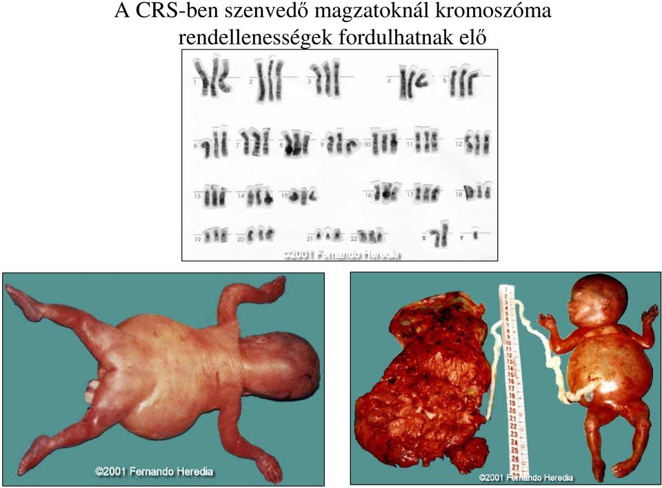 kromoszóma