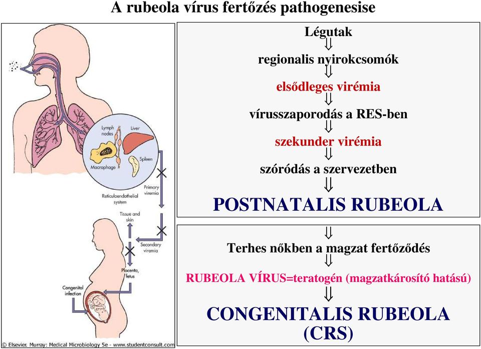 a szervezetben POSTNATALIS RUBEOLA Terhes nıkben a magzat fertızıdés